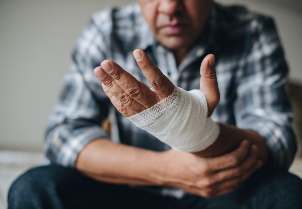 Photo of a Man with Injured Hand